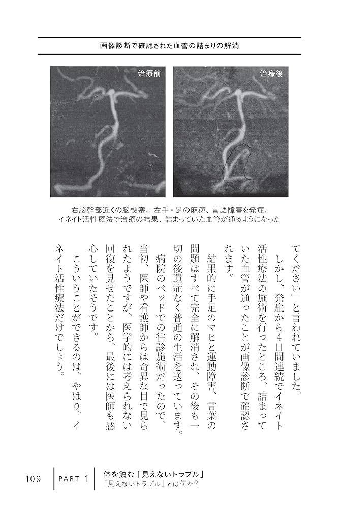 脳をリセットすれば、体はたちまち治りだす 治癒へのスイッチは最初の1分で決まる 脳をリセットすれば、体はたちまち治りだす 治療へのスイッチは